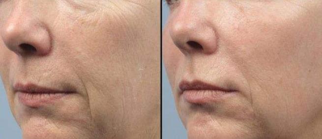 国人“瞧不起”的8款老牌国货，被日本人买到断货，可知道的人太少