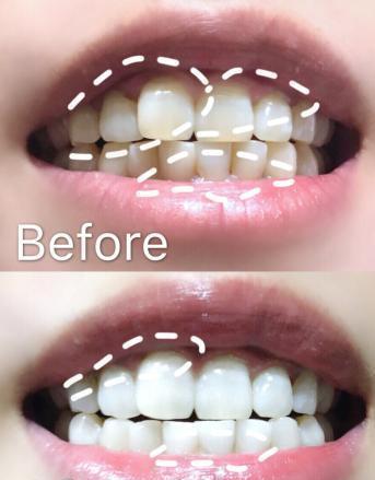 景甜随手晒的牙膏活了, 价格公布后, 网友堪称牙膏界的劳斯莱斯!