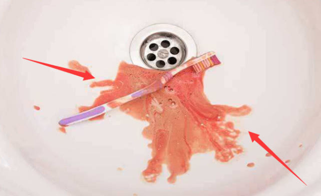 板栗|医生提醒：身上冒出“这玩意”，或是肝脏出了“大毛病”，速自查