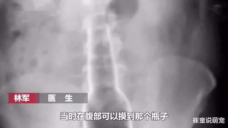 老顽童？60岁男子将18厘米长花露水瓶塞入直肠：想止痒的
