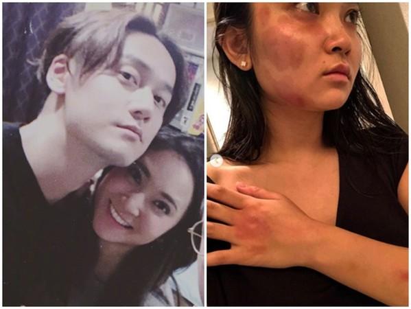 报警抓蒋劲夫施暴! 日籍女友改口: 我被媒体诱导, 反应过度