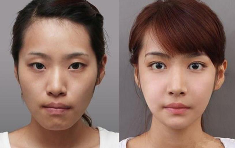 武汉协和医院自制药剂成“网红”，３次眼袋细纹全没了，平价兰蔻