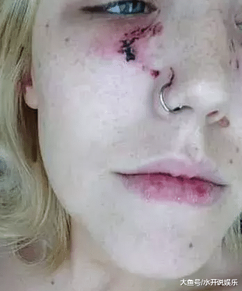 男子殴打怀孕四周的女友 自豪地说在网上出名了