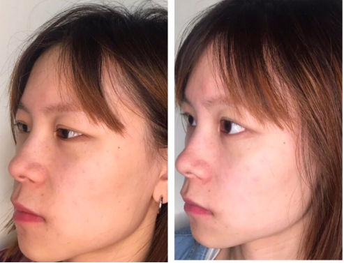 别花钱买“SK2小灯泡”了，自制美白“技巧”，你也能“白到发光”