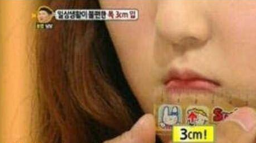 世界上嘴巴最小的女人，名副其实的樱桃小嘴，她却有无尽的烦恼