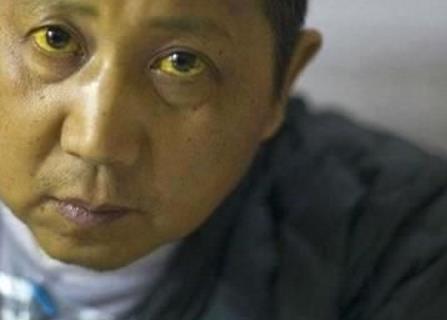 30岁女子患肝癌，平时不抽烟也不喝酒，医生：和“它”有关