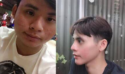 男子花4万多整容，吃1个月流食，外表满意了痛苦也值得