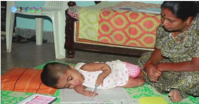 19岁少女一幅画可卖一万元，却只能每天躺在婴儿车里