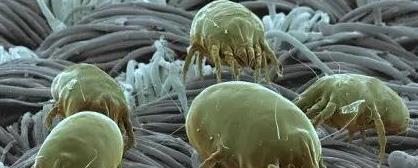 床上百万螨虫成窝？上海大妈只要一个小偏方，螨虫连根拔起！