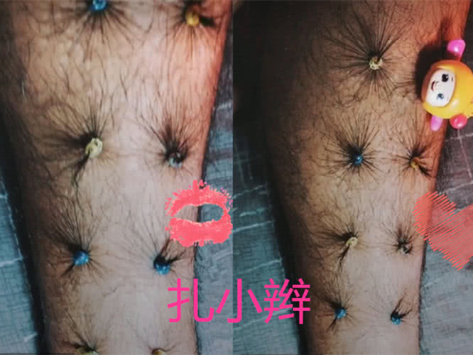 男生会怎么玩自己的腿毛？锡纸烫和扎小辫，看到最后：是个狼灭