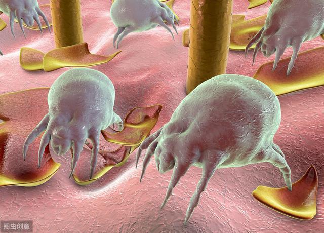 原来螨虫真 的很 怕这个，床上放一些，直接连窝端，螨虫一只不留