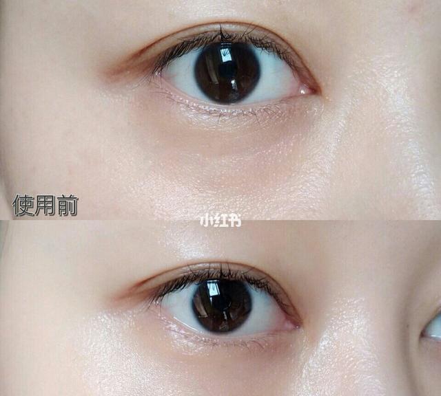 吴昕晒出的眼霜，因价格便宜被人瞧不起，网友：干燥脂肪粒快速消失