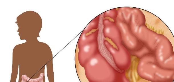 肝脏■人体有哪些器官可以直接拿掉，同时不影响生存？看完涨知识
