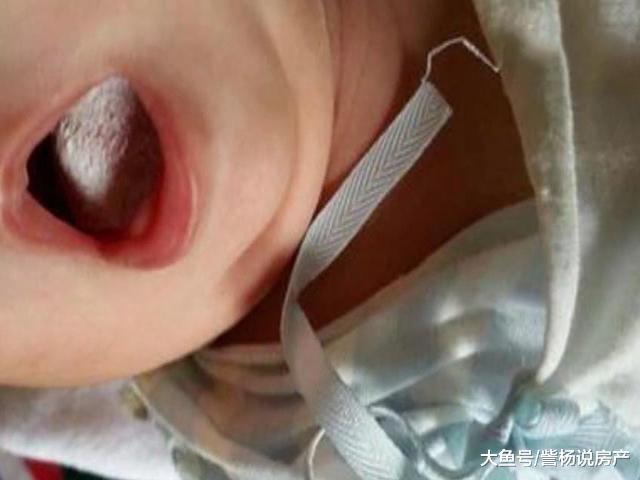 奶奶用毛巾擦了宝宝这个部位, 导致宝宝患上败血症, 家长别大意