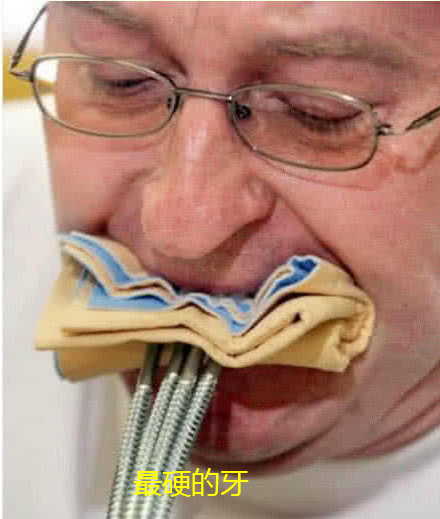 吉尼斯世界记录：世界上最坚硬的牙，直接开瓶盖，看着都疼