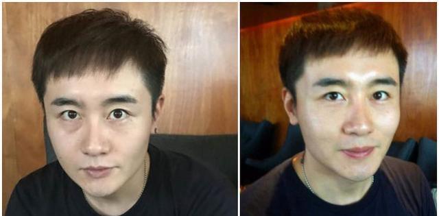 药店有个“神奇小怪兽”, 只需120秒眼袋全消失, 效果不输激光