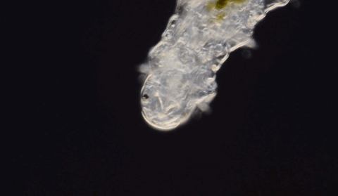 仅用一勺盐，就把家中螨虫斩草除根，连尸体都找不到