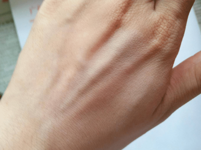 肾脏功能“稀烂”的男人，手上“3特征”贼明显，快自检