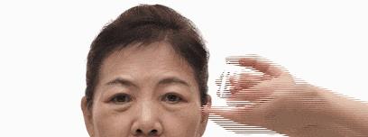 药店有个“神奇小怪兽”, 只需120秒眼袋全消失, 效果不输激光