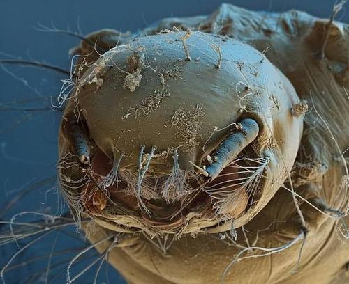 脸上经常长痘痘，那是螨虫在作怪，美容师说：螨虫不除，它会一直危害我们的皮肤