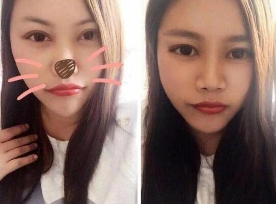 号称绝不整容的“凤姐”整容后堪比换头, 美得让人惊艳