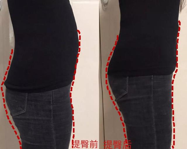 屁股扁平娜扎都无可奈何！性感蜜桃臀不是非要撸铁，秒提臀还细腿