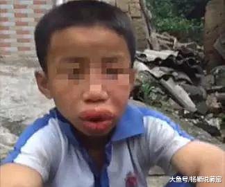 小男孩遭父亲胖揍，变成香肠嘴，却引来网友拍手叫好