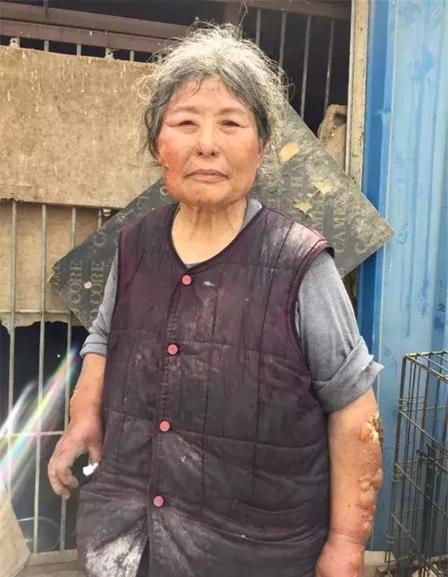 流浪狗基地被人故意纵火，她却义无反顾冲进大火中……