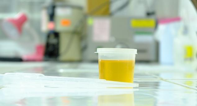 男人排尿若出现3个“异常”，可能是“淋病”的早期信号，别大意