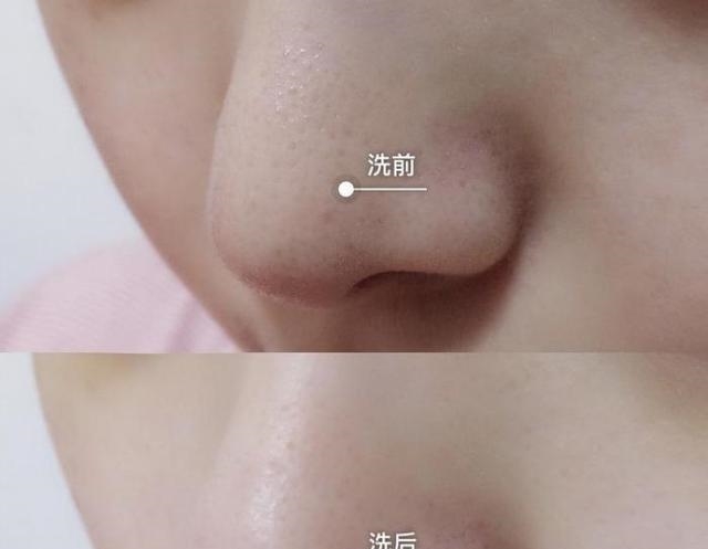 让香奈儿都羞愧的“妖孽”洗面奶，清洁力超强，黑头闭口都不见了