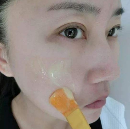 102岁姥姥告诉我：药店“平价药膏”每天5秒钟，黄褐斑、雀斑都拜拜！