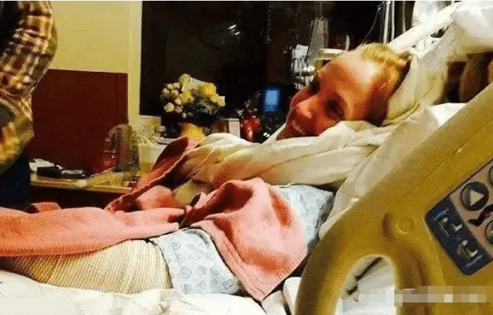 女子发现左手有一小块红肿没在意, 隔天整个手臂已经被吃掉一半