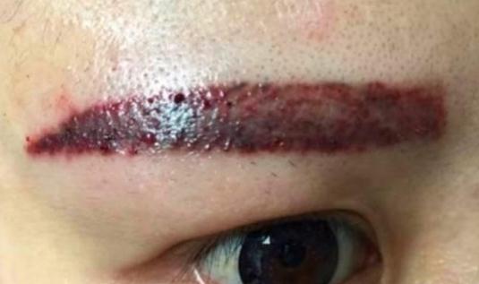 蜂蜜 千万别再跟风去纹眉,背后的危害现在知道还不迟,有可能少活十年