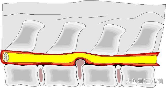 狗狗不要太胖！一胖起来，恐怕椎间盘疾病会让狗瘫痪