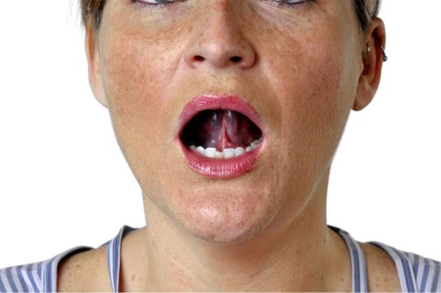 中风来临早知道：头上出现这3个信号，提示你的脑血管有可能堵了