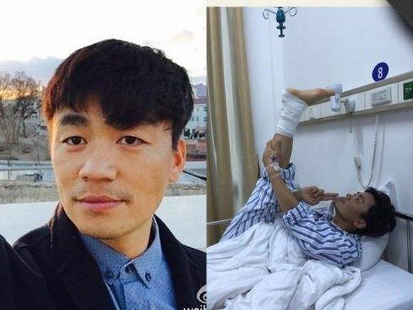 在综艺中出意外的明星，李晨头缝22针，他抢救六天还是不幸死亡！