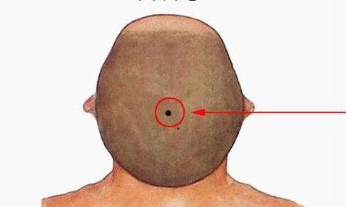 身体六大好运痣，非富即贵，个个人中龙凤，拥有万贯家财！