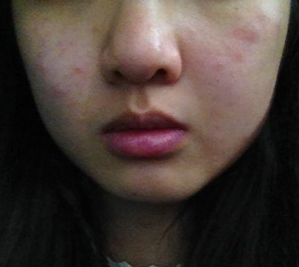 皮肤科医生警告：这样混用大牌护肤品，你的皮肤不差谁差