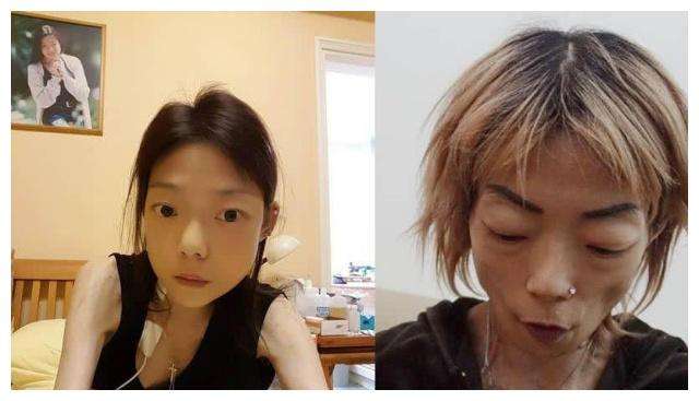 22岁嫁入豪门，因全身瘫痪遭丈夫抛弃，如今成骷髅人让人心疼