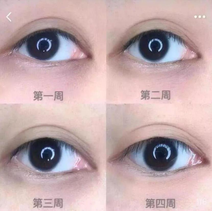 武汉协和医院自制药剂成“网红”，３次眼袋细纹全没了，平价兰蔻