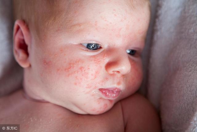 拜拜了螨虫，1个土法子，睡前用一用，只 要2天就把螨虫斩草除根