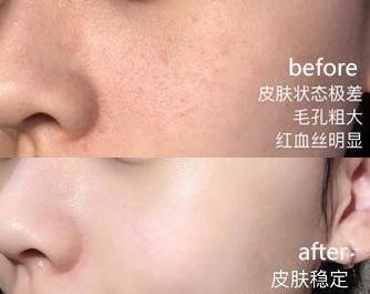 孙怡随手晒出的面膜，欧阳娜娜：平价skII，网友：不到1个月就白了