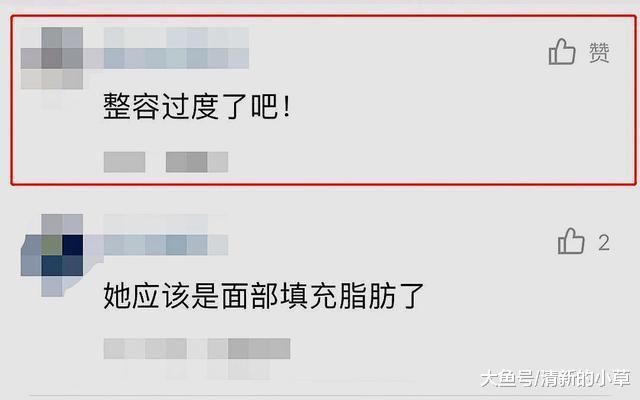 女孩因戴墨镜意外走红，摘下眼镜的那一刻，网友整容过度了吧！