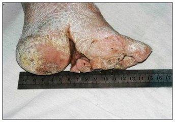 ”三寸金莲”有多小，又有多少沧桑无奈？