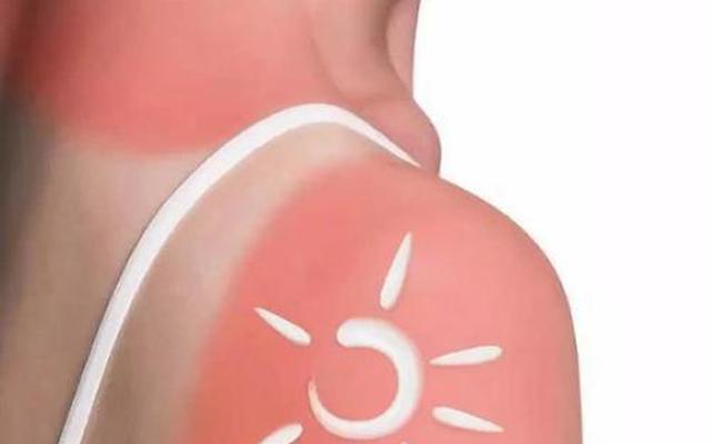 炎炎夏日，晒脱皮了怎么办 试试这晒脱皮了怎么处理恢复快