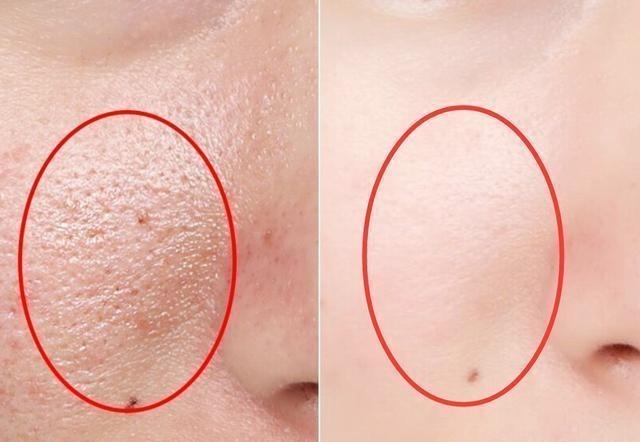 真假难辨！泰国化妆品都是伪劣产品，你还敢代购吗？