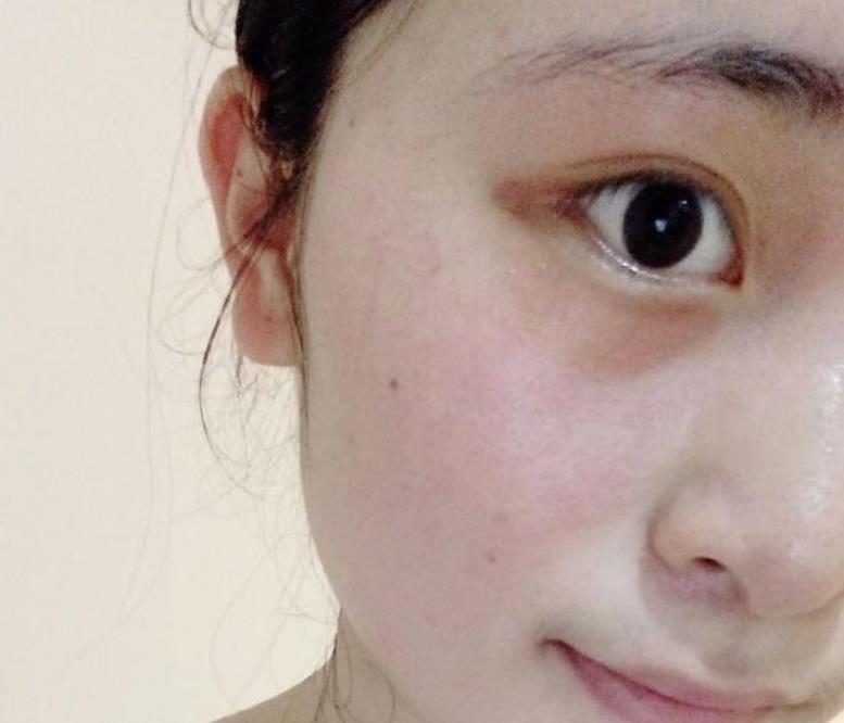 药店最火的“变态”发明，3次眼袋细纹全没了，半个娱乐圈人手一支