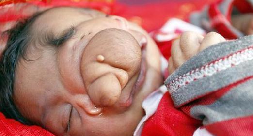 环境污染造成婴儿面部畸形，却被众人认为是神仙转世