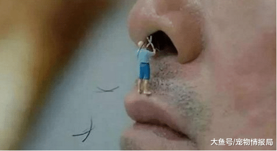 喜欢挖鼻孔的人，最后都怎么样了？这3个“麻烦”自动找上门来！