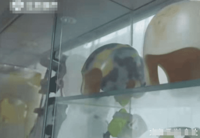 男童戴矫形头盔竟成奥特曼, 找卖家索要赔偿被拒, 卖家: 正常现象